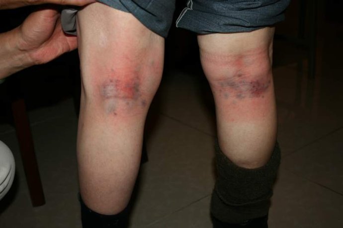 Image result for paida the knees