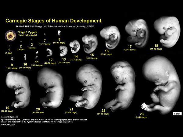 Click image for larger version

Name:	Human_Carnegie_stage_1-23.jpg
Views:	398
Size:	51.0 KB
ID:	22140
