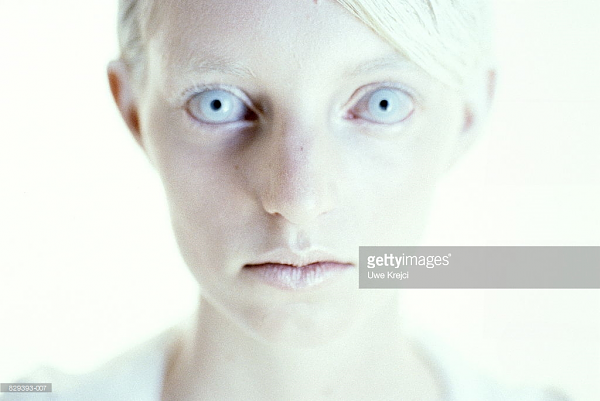 Click image for larger version

Name:	Albino model, photo by Uwe Krejci (1).png
Views:	315
Size:	567.8 KB
ID:	33399