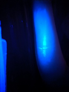 Name:  powder blue mark on arm.jpg
Views: 131
Size:  11.7 KB